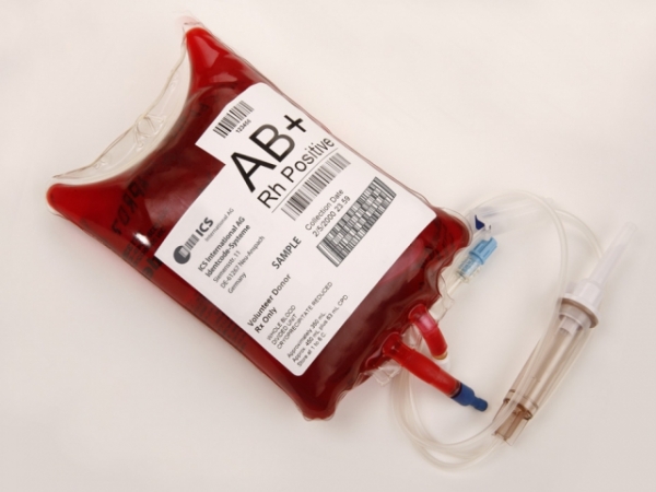 When it comes to blood, are you squeamish?